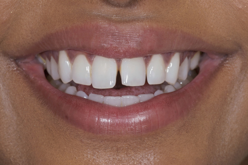 Grishma Instant Orthodontics S B4 9979